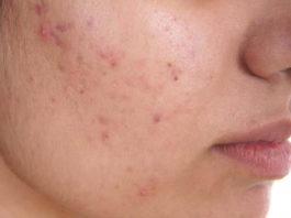 skin diseases causes and treatment