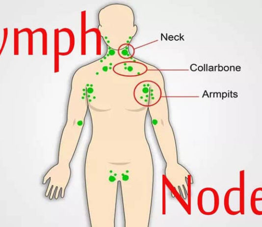 Natural Remedies For Your Lymphatic Nodes